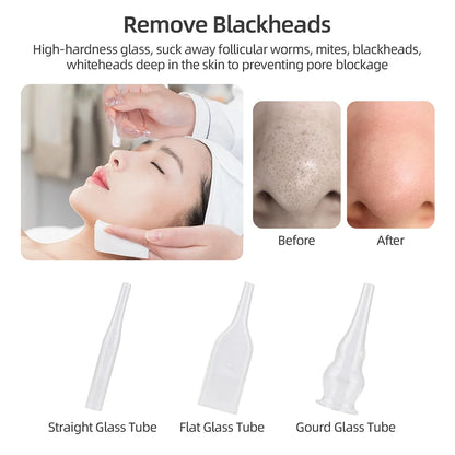 Home Use Facial Diamond Microdermabrasion Machine