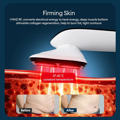 Body Slimming Massager Electric Body Slimmer Fat Remover