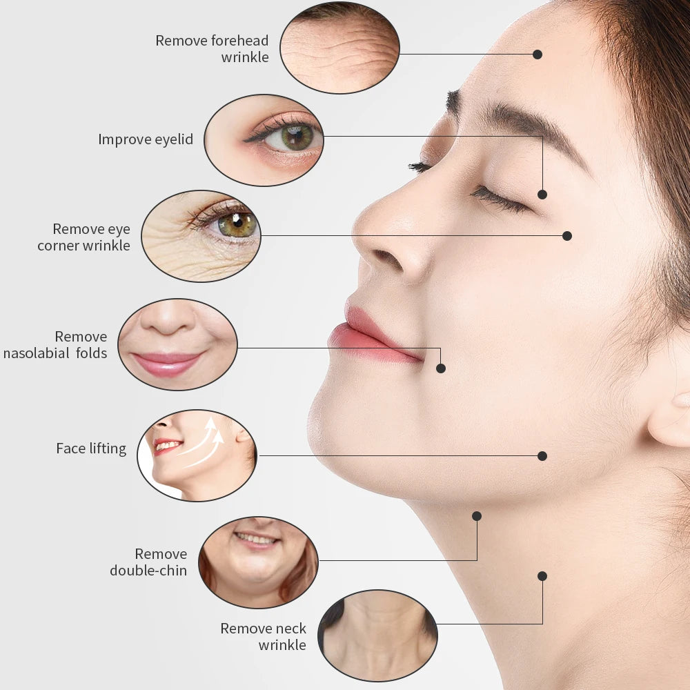 2MHz Tripolar Radio Frequency Face Body Skin Lifting