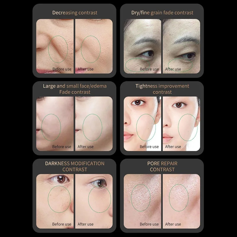 Red Light Collagen Regeneration Anti-Aging RF Anti-Wrinkle Beauty Device