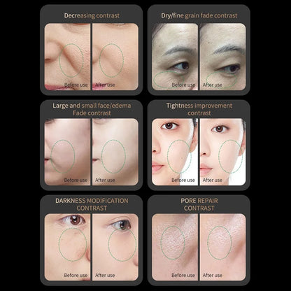 Red Light Collagen Regeneration Anti-Aging RF Anti-Wrinkle Beauty Device