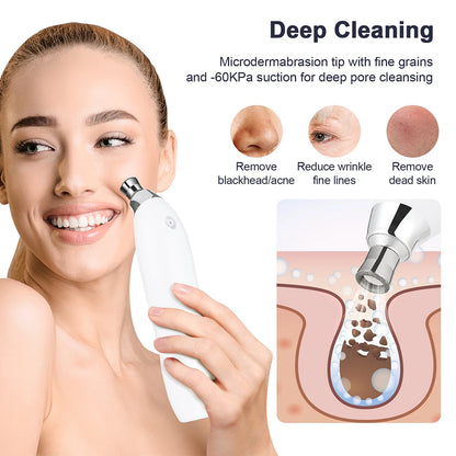 Portable Diamond Microdermabrasion Facial Peeling Machine