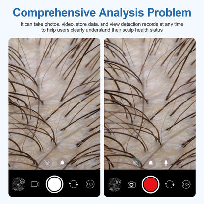 Portable Hair Follicle Scalp Detector