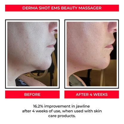 3d Sculptor Beauty Roller Face V Line Beauty Instrument